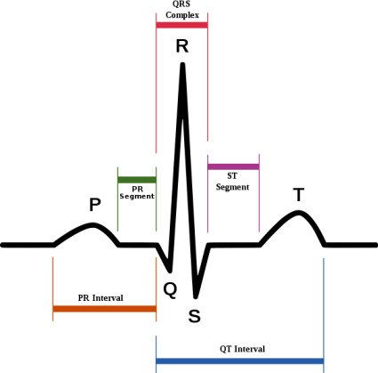 Normal ECG Trace